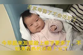 医生说舌头下面这个必须剪，不然影响以后说话视频封面