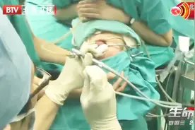 悲剧接连发生，喉咙卡住异物竟致命，医生曾取出带刺金属链！