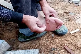 工友不慎被钉子扎脚，流了点血，扎一个小洞使劲敲打伤口