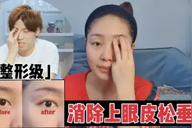 3分钟消除上眼睑下垂，改善眼皮松弛，做一次就有惊喜哦视频封面