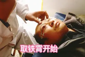 光头哥眼睛进了铁霄，去医院花300多块钱，看看医生怎么取出来的视频封面