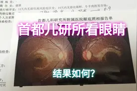 小朋友眼睛在太阳下睁不开还刺痛，来首都儿研所看看到底啥毛病？视频封面