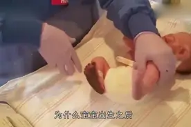刚出生的小孩为什么都要留脚印？退休护士说出隐情，出事了顶大用