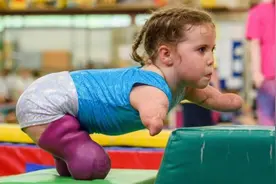 5岁小女孩因病失去四肢 却爱上体操这项高难度运动