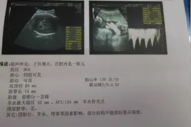 双顶径与股骨长可以推测男宝女宝吗？六胎妈妈来打脸！视频封面