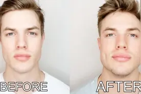 国外小哥每天一包口香糖，吃了一年，以为会瘦脸，结果却是大变样