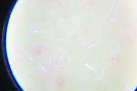 显微镜下桃子上的毛，就是它们蹭到我们的皮肤上令我们奇痒无比视频封面