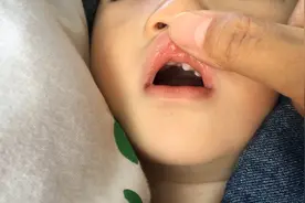 吃奶嘴的宝宝牙齿和嘴巴变这样？宝妈分享亲身经历告诉你，利与弊