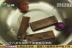 女孩体内竟有多个玩具，医生将其取出，专家：这方面不能忽略视频封面