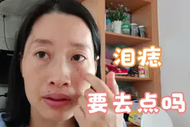 听说痣长在眼睛下面命不好，很多网友都建议去点掉，我该相信吗视频封面