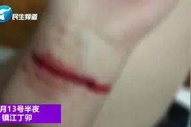 镇江：半夜，她在朋友圈发了一张血淋淋的照片