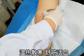 80岁奶奶受凉老寒腿疼痛发作，坚强接受刺血拔罐，治完立感轻松