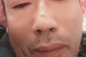 快手极速版