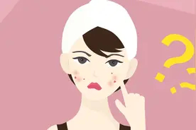 脸上长痘痘脱皮是怎么回事？是好转的征兆吗？要不要管？视频封面