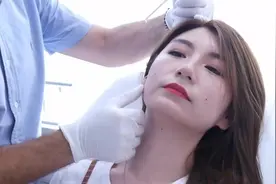 圆脸变V脸，网友分享初次瘦脸针经历+过程+后遗症+心得+肉毒科普视频封面
