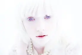 女孩从小身患白化病，被旁人欺凌排挤，成大后却成了仙女