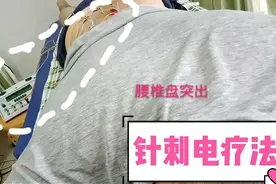 30岁的小伙椎间盘突出了，用针刺电疗法感觉自己是个“小白鼠”视频封面
