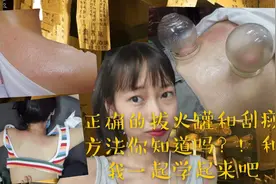 不看后悔系列你会拔火罐吗？快来和医学生学习正确的拔火罐和刮痧视频封面