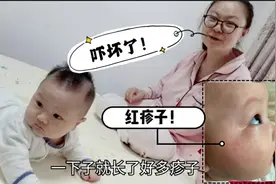 宝宝脸上屁股上红红的，一片片疹子！把小宝妈吓的不轻！咋回事？视频封面