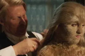 女孩从小就浑身长满毛发，爸爸担心她被人嘲笑，整天把她锁在家里视频封面