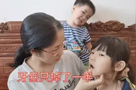 求支招：7岁女孩换牙，只掉一半，牙根没掉，需要去医院拔掉吗？视频封面