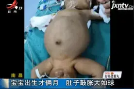 南昌：宝宝出生才俩月 肚子鼓胀大如球视频封面