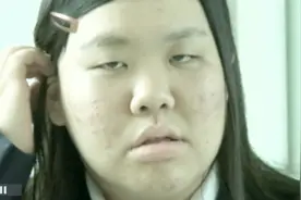 恐龙妹为了变美，到医院拼命整容减肥，最终成功嫁给男神视频封面