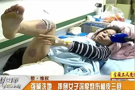 女子当街滑到摔跤，竟摔成二级到三级烧伤，去医院植皮三次视频封面