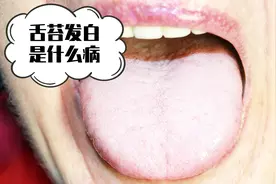 舌苔白是什么病？很可能是这些疾病发出的警报，一旦发现，要当心