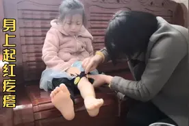 孩子身上起红疙瘩，痒的难受老是用手去抓宝妈用自家泡的药酒止痒视频封面