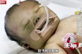 千里救心1：婴儿嘴唇黑紫，肚子格外肿胀，他究竟怎么了？视频封面