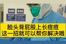 脸、头、背、屁股上长痘痘，这一招就可以帮你解决哦-硫磺皂