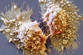 中药活血化瘀辅助治疗到底有没有用？肿瘤患者应该怎么选择视频封面