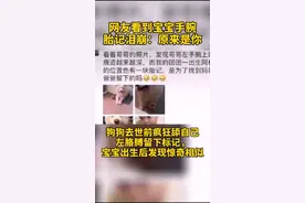 狗狗去世前留下标记与宝宝手臂胎记极其相似网友：也许是另种陪伴