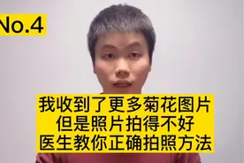 网上找医生看痔疮，拍照姿势很重要，照片拍得好，医生好诊断