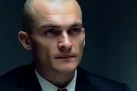 车不能开太快，不然会掉头发视频封面