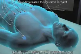 3D动画演示全身麻醉手术全过程，看上去没有你想象的恐怖！