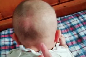 宝宝十一个多月了，后脑勺还有一块凹槽，到底是怎么回事？视频封面