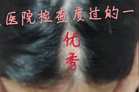 19岁少年为何头骨逐渐凹陷，是病吗？还是因为太过优秀？视频封面