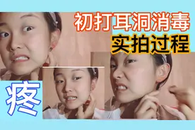 【打耳洞｜女孩初次打耳洞，实拍消毒过程，一个字就是—真疼！】