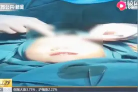 局部麻醉后，5岁女孩手术中唱歌，乐观乖巧获医生称赞！视频封面