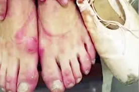 为什么人们都说，芭蕾舞者的脚“不见天日”？看完让人心疼不已！视频封面