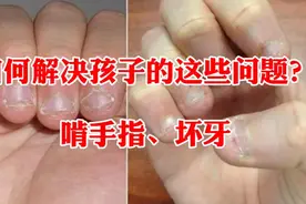 两招解决孩子啃手指、坏牙的情况？作为父母不妨试一下视频封面
