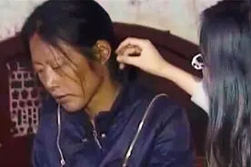 女子白皙皮肤突然变黑，颜值被拉低，既不是晒黑的也并非家族遗传