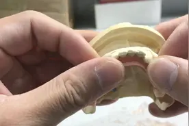 活动假牙胶托跟隐形托哪个更好，家建给大家详细解说