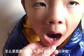 宝的牙齿活动了好多天，外面的没掉里面长出一个小牙，有啥好建议