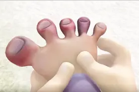 熊出没：可怜的光头强，脚趾被冻的又红又肿