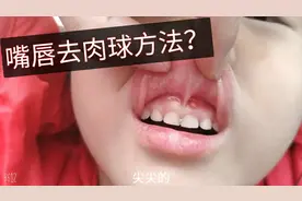 嘴唇上方长个肉球，疫情期间，该如何处理呢？视频封面