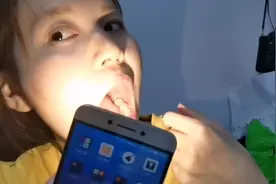 24岁妹子长智齿，痛的吃不下饭，相同经历的你们有啥绝招？