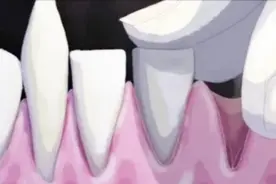扭曲人性动画《牙齿》，男孩为了让牙掉落，疯狂舔牙床啃桌子视频封面